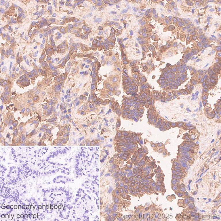Immunohistochemistry (Formalin/PFA-fixed paraffin-embedded sections) - Anti-Calpain 2 antibody [EPR29833-94] (AB325140)