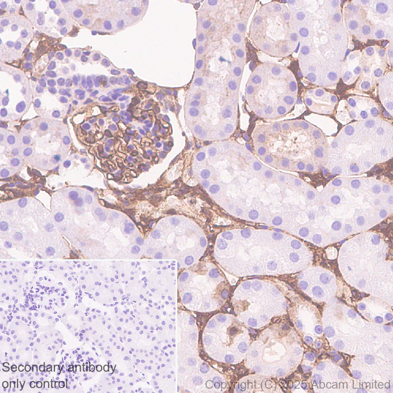 Immunohistochemistry (Formalin/PFA-fixed paraffin-embedded sections) - Anti-Calpain 2 antibody [EPR29833-94] (AB325140)