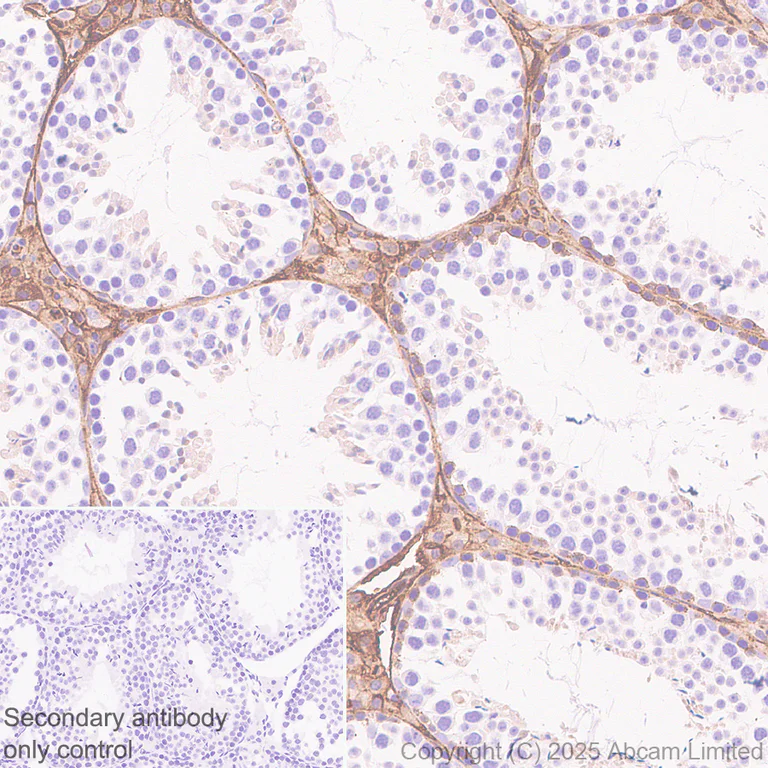 Immunohistochemistry (Formalin/PFA-fixed paraffin-embedded sections) - Anti-Calpain 2 antibody [EPR29833-94] (AB325140)