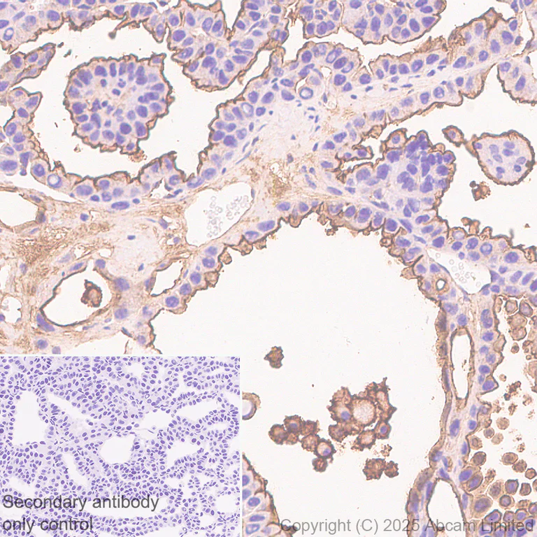Immunohistochemistry (Formalin/PFA-fixed paraffin-embedded sections) - Anti-Calpain 2 antibody [EPR29833-94] (AB325140)