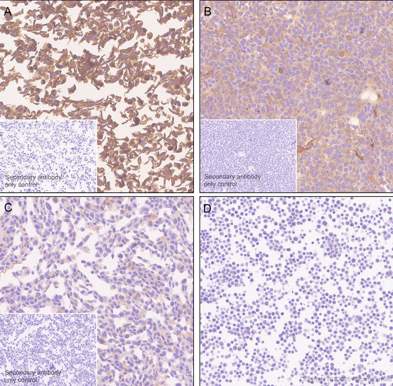 Immunohistochemistry (Formalin/PFA-fixed paraffin-embedded sections) - Anti-Calpain 2 antibody [EPR29833-94] (AB325140)