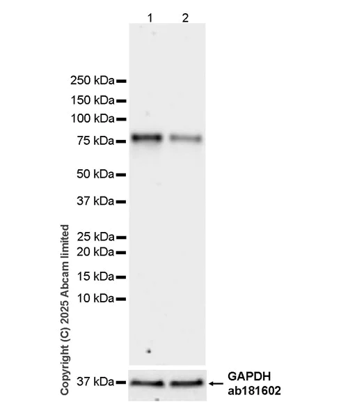 Western blot - Anti-Calpain 2 antibody [EPR29833-94] (AB325140)