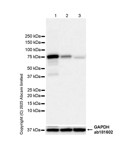 Western blot - Anti-Calpain 2 antibody [EPR29833-94] (AB325140)