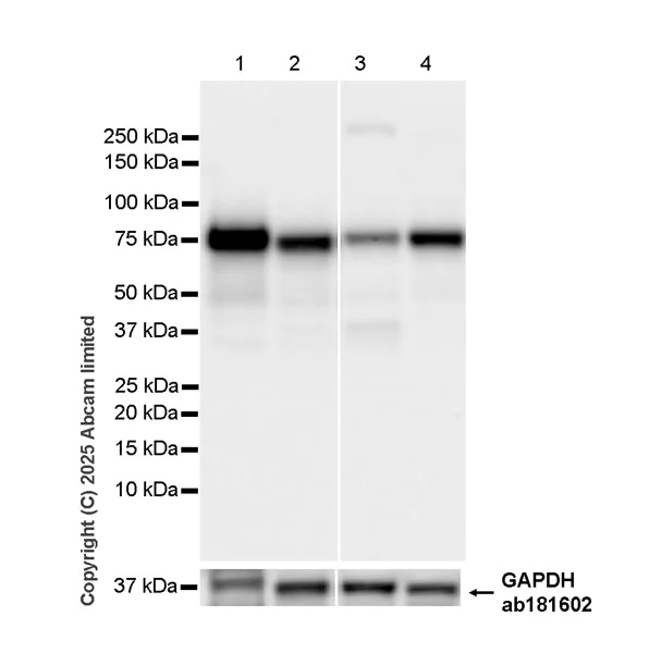 Western blot - Anti-Calpain 2 antibody [EPR29833-94] (AB325140)