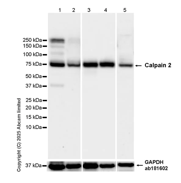 Western blot - Anti-Calpain 2 antibody [EPR29833-94] (AB325140)