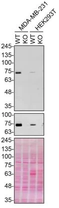 Western blot - Anti-Calpain 2 antibody [EPR5977] (AB126600)