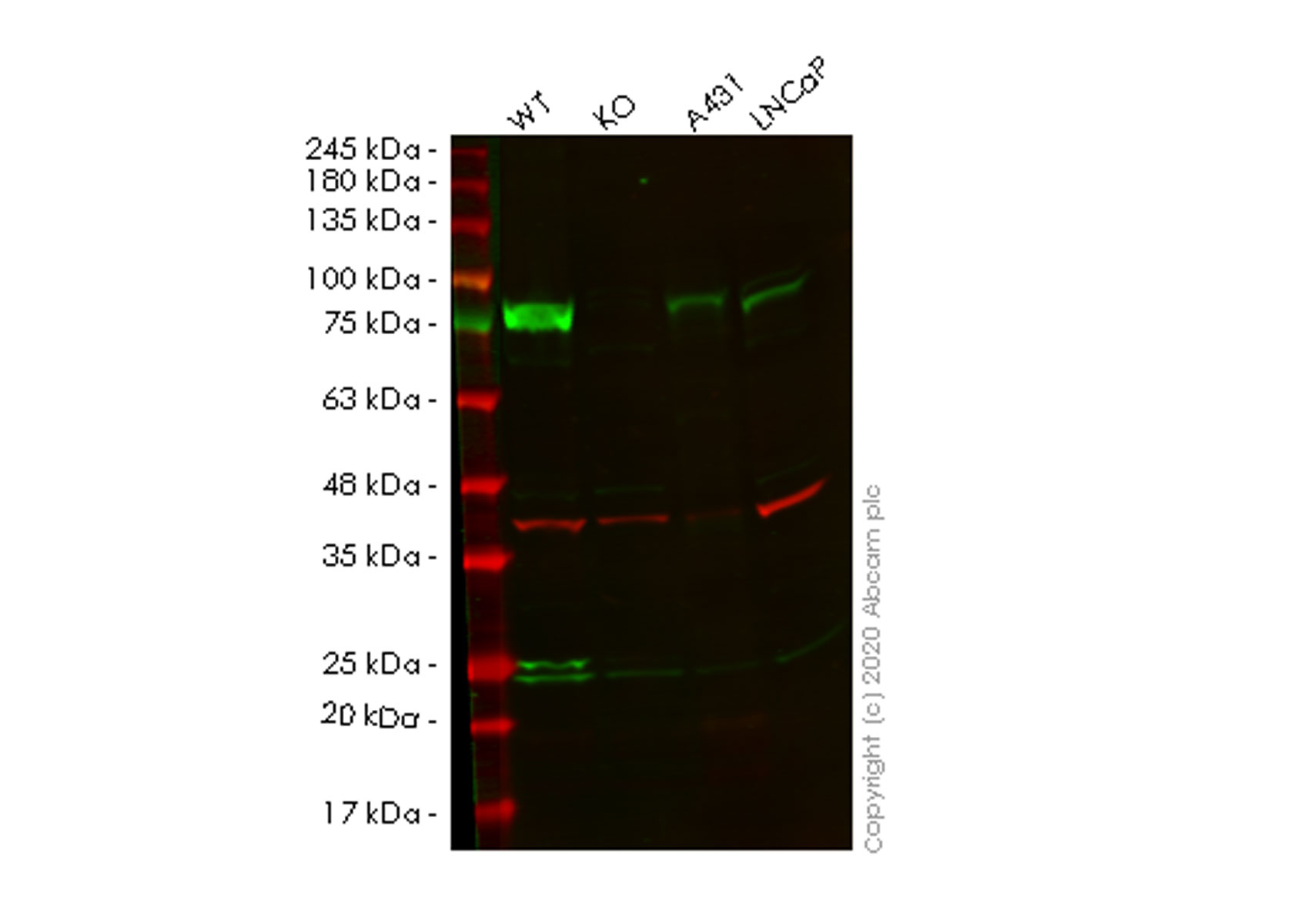 Western blot - Anti-Calpain 2 antibody [EPR5977] (AB126600)