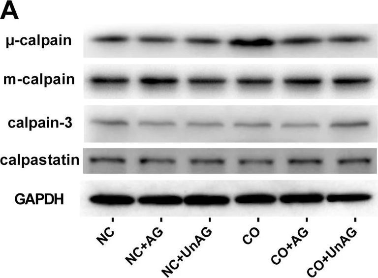 Western blot - Anti-Calpain 2 antibody [EPR5977] (AB126600)