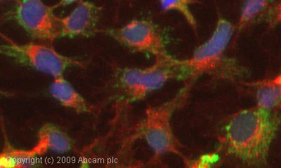 Immunocytochemistry/ Immunofluorescence - Anti-Calpain 5 antibody (AB28280)