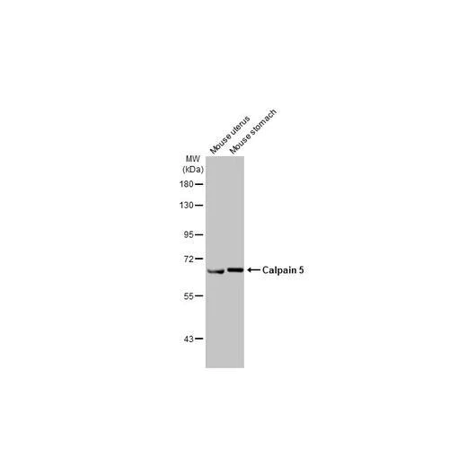 Western blot - Anti-Calpain 5 antibody [HL2432] (AB317224)