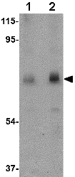 Western blot - Anti-Calpain 6 antibody (AB76974)