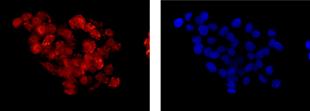 Immunocytochemistry/ Immunofluorescence - Anti-Calpain 9 antibody [EPR13422] (AB181178), expandable thumbnail