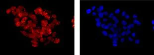 Immunocytochemistry/ Immunofluorescence - Anti-Calpain 9 antibody [EPR13422] - BSA and Azide free (AB250404)