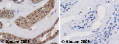 Immunohistochemistry (Formalin/PFA-fixed paraffin-embedded sections) - Anti-Calpain small subunit 1 antibody (AB28237)