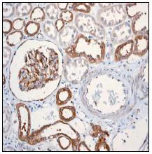 Immunohistochemistry (Formalin/PFA-fixed paraffin-embedded sections) - Anti-Calpain small subunit 1 antibody [EPR3323] (AB92356)