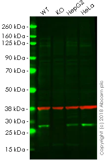 Western blot - Anti-Calpain small subunit 1 antibody [EPR3323] (AB92356)