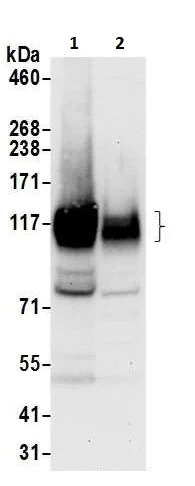 Western blot - Anti-Calpastatin antibody (AB226249)