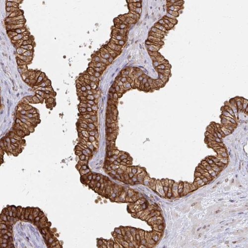 Immunohistochemistry (Formalin/PFA-fixed paraffin-embedded sections) - Anti-Calpastatin antibody (AB244460)