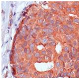 Immunohistochemistry (Formalin/PFA-fixed paraffin-embedded sections) - Anti-Calpastatin antibody [SP82] (AB101684)