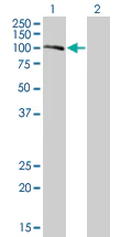 Western blot - Calpastatin overexpression 293T lysate (whole cell) (AB94277)