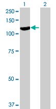 Western blot - Calpastatin overexpression 293T lysate (whole cell) (AB94278), expandable thumbnail