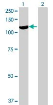 Western blot - Calpastatin overexpression 293T lysate (whole cell) (AB94278)