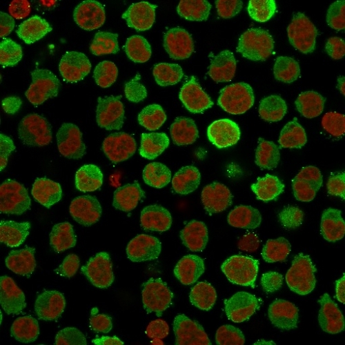 Immunocytochemistry - Anti-Calponin 1 antibody [CNN1/832 + CALP] - BSA and Azide free (AB212306), expandable thumbnail