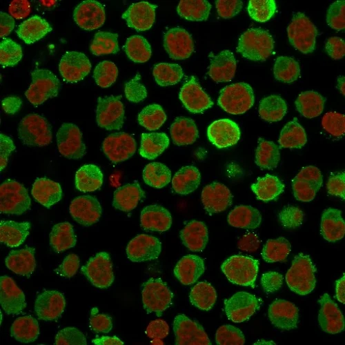 Immunocytochemistry - Anti-Calponin 1 antibody [CNN1/832 + CALP] - BSA and Azide free (AB212306)