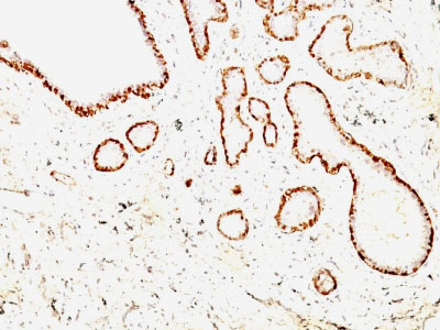 Immunohistochemistry (Formalin/PFA-fixed paraffin-embedded sections) - Anti-Calponin 1 antibody [CNN1/832 + CALP] - BSA and Azide free (AB212306), expandable thumbnail