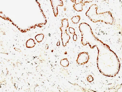 Immunohistochemistry (Formalin/PFA-fixed paraffin-embedded sections) - Anti-Calponin 1 antibody [CNN1/832 + CALP] - BSA and Azide free (AB212306)