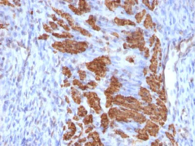 Immunohistochemistry (Formalin/PFA-fixed paraffin-embedded sections) - Anti-Calponin 1 antibody [CNN1/832 + CALP] - BSA and Azide free (AB212306)