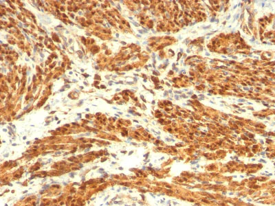 Immunohistochemistry (Formalin/PFA-fixed paraffin-embedded sections) - Anti-Calponin 1 antibody [CNN1/832 + CALP] - BSA and Azide free (AB212306)
