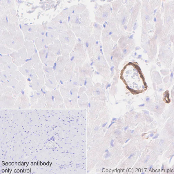 Immunohistochemistry (Formalin/PFA-fixed paraffin-embedded sections) - Anti-Calponin 1 antibody [EP798Y] (AB46794)