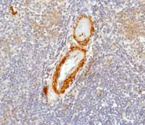 Immunohistochemistry (Formalin/PFA-fixed paraffin-embedded sections) - Anti-Calponin 1 antibody [EP798Y] (AB46794)