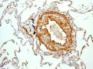Immunohistochemistry (Formalin/PFA-fixed paraffin-embedded sections) - Anti-Calponin 1 antibody [EP798Y] (AB46794)