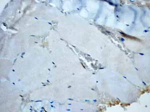 Immunohistochemistry (Formalin/PFA-fixed paraffin-embedded sections) - Anti-Calponin 1 antibody [EP798Y] (AB46794)