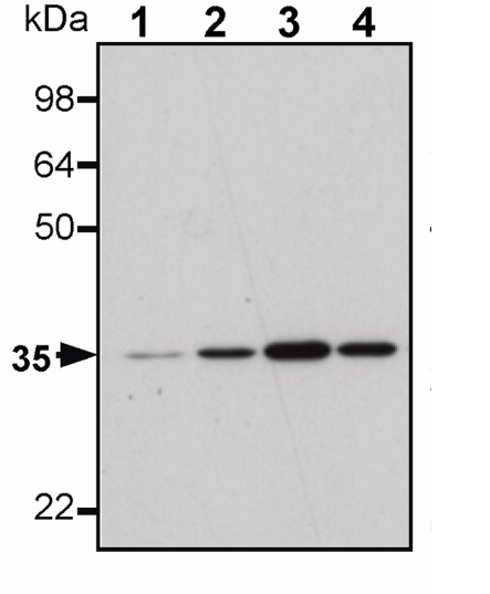 Western blot - Anti-Calponin 1 antibody [EP798Y] (AB46794), expandable thumbnail