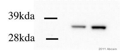 Western blot - Anti-Calponin 1 antibody [EP798Y] (AB46794), expandable thumbnail