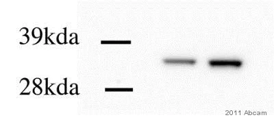Western blot - Anti-Calponin 1 antibody [EP798Y] (AB46794)