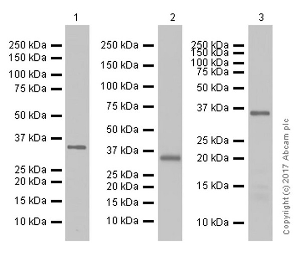 Western blot - Anti-Calponin 1 antibody [EP798Y] (AB46794), expandable thumbnail