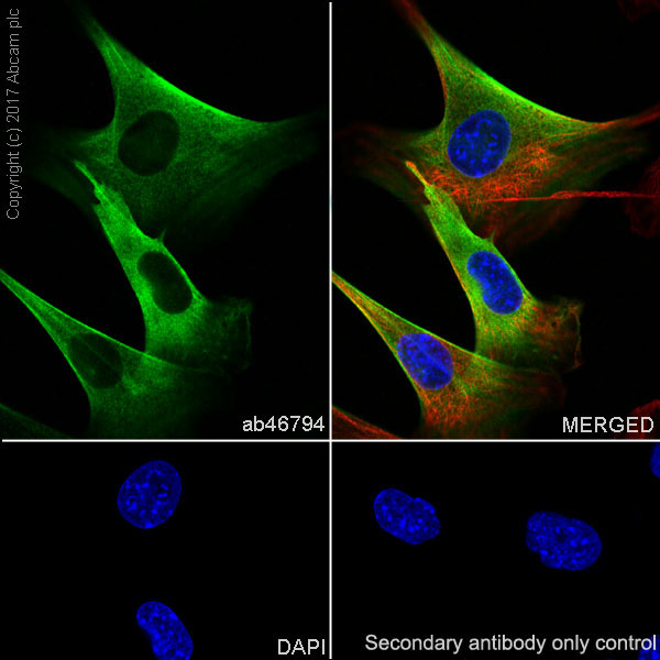 Immunocytochemistry/ Immunofluorescence - Anti-Calponin 1 antibody [EP798Y] - BSA and Azide free (AB216651), expandable thumbnail
