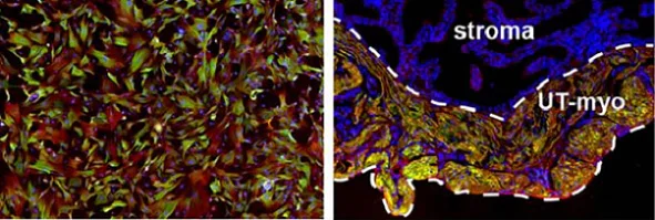 Immunocytochemistry/ Immunofluorescence - Anti-Calponin 1 antibody [EP798Y] - BSA and Azide free (AB216651)