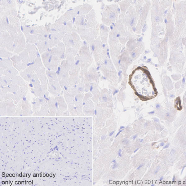 Immunohistochemistry (Formalin/PFA-fixed paraffin-embedded sections) - Anti-Calponin 1 antibody [EP798Y] - BSA and Azide free (AB216651), expandable thumbnail