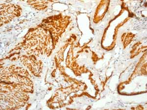 Immunohistochemistry (Formalin/PFA-fixed paraffin-embedded sections) - Anti-Calponin 1 antibody [EP798Y] - BSA and Azide free (ab216651), expandable thumbnail