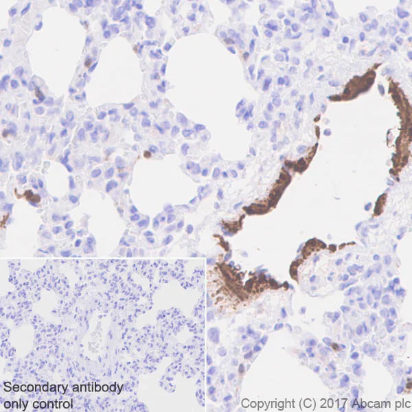 Immunohistochemistry (Formalin/PFA-fixed paraffin-embedded sections) - Anti-Calponin 1 antibody [EP798Y] - BSA and Azide free (AB216651)