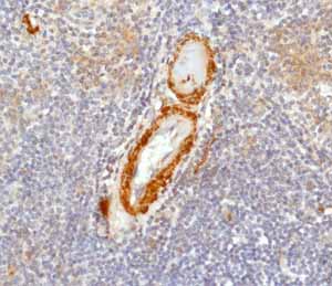 Immunohistochemistry (Formalin/PFA-fixed paraffin-embedded sections) - Anti-Calponin 1 antibody [EP798Y] - BSA and Azide free (ab216651), expandable thumbnail
