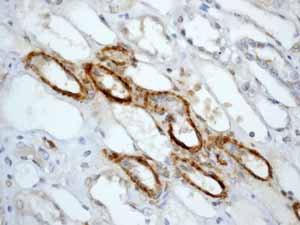 Immunohistochemistry (Formalin/PFA-fixed paraffin-embedded sections) - Anti-Calponin 1 antibody [EP798Y] - BSA and Azide free (ab216651), expandable thumbnail
