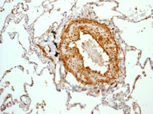 Immunohistochemistry (Formalin/PFA-fixed paraffin-embedded sections) - Anti-Calponin 1 antibody [EP798Y] - BSA and Azide free (ab216651), expandable thumbnail