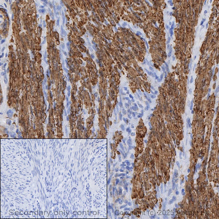 Immunohistochemistry (Formalin/PFA-fixed paraffin-embedded sections) - Anti-Calponin 1 antibody [EP798Y] - BSA and Azide free (AB216651)