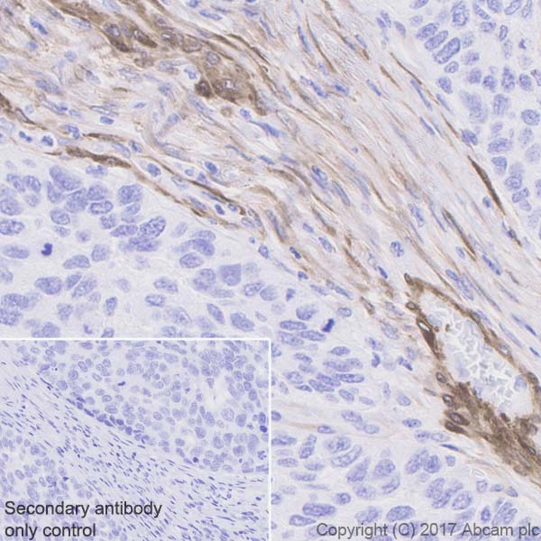 Immunohistochemistry (Formalin/PFA-fixed paraffin-embedded sections) - Anti-Calponin 1 antibody [EP798Y] - BSA and Azide free (ab216651), expandable thumbnail